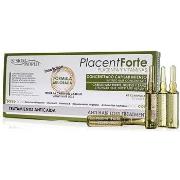 Accessoires cheveux Sesiom World Placent Forte Ampoules Traitement Ant...