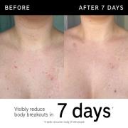 The INKEY List Stick Corps Exfoliant à l'Acide Glycolique 45 g
