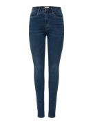 Only Onlroyal hw skinny jeans bb bj13964